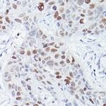 RBPJ Recombinant Rabbit Monoclonal Antibody (9B3L6)