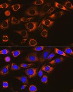 FAAH Recombinant Rabbit Monoclonal Antibody (10A1M7)