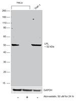 LPL Recombinant Rabbit Monoclonal Antibody (10E10P9)