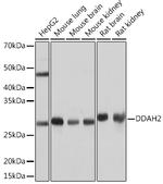 DDAH2 Recombinant Rabbit Monoclonal Antibody (5M4Y4)