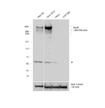 Apolipoprotein B Recombinant Rabbit Monoclonal Antibody (2T5X0)