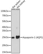 Aquaporin 1 Recombinant Rabbit Monoclonal Antibody (8V1O3)