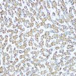 CPS1 Recombinant Rabbit Monoclonal Antibody (1R6W3)