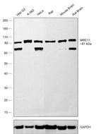 MRE11 Recombinant Rabbit Monoclonal Antibody (8Q2B3)