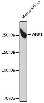 WNK1 Recombinant Rabbit Monoclonal Antibody (6C5S6)