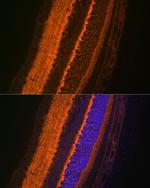 VAMP2 Antibody in Immunohistochemistry (Paraffin) (IHC (P))