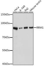RRM1 Recombinant Rabbit Monoclonal Antibody (4P4U1)