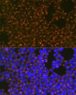 CCR8 Recombinant Rabbit Monoclonal Antibody (9N1Y1)