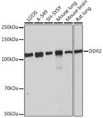 DDR2 Recombinant Rabbit Monoclonal Antibody (1M8U7)