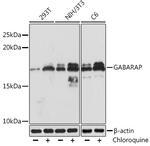 GABARAP Recombinant Rabbit Monoclonal Antibody (5T6W5)
