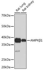 AMPK beta-1 Antibody in Western Blot (WB)