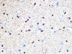 Stathmin 1 Antibody in Immunohistochemistry (Paraffin) (IHC (P))