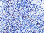 Stathmin 1 Antibody in Immunohistochemistry (Paraffin) (IHC (P))