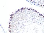 Stathmin 1 Antibody in Immunohistochemistry (Paraffin) (IHC (P))