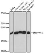 Stathmin 1 Antibody in Western Blot (WB)