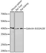 Galectin 8 Recombinant Rabbit Monoclonal Antibody (7M9Q9)