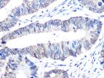 UBC9 Recombinant Rabbit Monoclonal Antibody (6Z9V6)