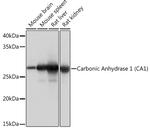 Carbonic Anhydrase I Recombinant Rabbit Monoclonal Antibody (0G10F8)