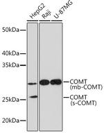 COMT Recombinant Rabbit Monoclonal Antibody (9Y2A3)