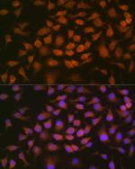 GRK2 Recombinant Rabbit Monoclonal Antibody (1E5K3)