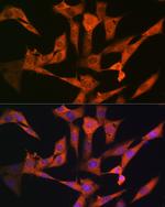 USP10 Recombinant Rabbit Monoclonal Antibody (9L6F3)