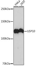 USP10 Antibody in Western Blot (WB)
