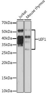 LEF1 Recombinant Rabbit Monoclonal Antibody (9I9T4)