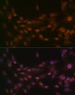 PRMT1 Antibody in Immunocytochemistry (ICC/IF)