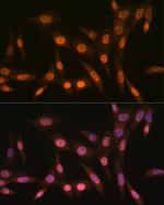 PRMT1 Recombinant Rabbit Monoclonal Antibody (10W10U4)