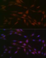 CK2 beta Recombinant Rabbit Monoclonal Antibody (9T5J10)