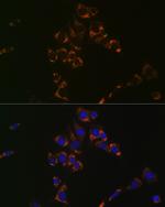 Aconitase 2 Antibody in Immunocytochemistry (ICC/IF)