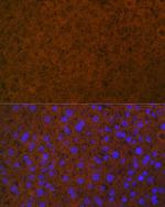 Protein C Recombinant Rabbit Monoclonal Antibody (3W3R7)