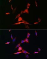 RARB Antibody in Immunocytochemistry (ICC/IF)