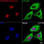 DHX9 Recombinant Rabbit Monoclonal Antibody (2I6C5)