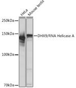 DHX9 Antibody in Western Blot (WB)