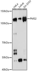 PMS2 Recombinant Rabbit Monoclonal Antibody (4E5F1)