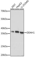 DDAH1 Recombinant Rabbit Monoclonal Antibody (1Q5F6)