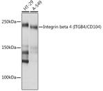 CD104 Recombinant Rabbit Monoclonal Antibody (5Z9P3)