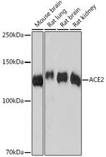 ACE2 Antibody in Western Blot (WB)