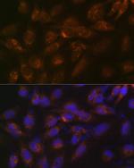 IGFBP7 Recombinant Rabbit Monoclonal Antibody (8M10Q9)