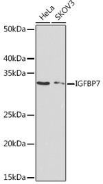 IGFBP7 Antibody in Western Blot (WB)