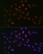 MTA2 Recombinant Rabbit Monoclonal Antibody (9A5Y7)