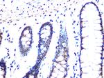 MAD2L2 Antibody in Immunohistochemistry (Paraffin) (IHC (P))