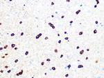 TPPP Antibody in Immunohistochemistry (Paraffin) (IHC (P))