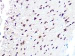 TPPP Recombinant Rabbit Monoclonal Antibody (3S5U9)
