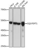 FDFT1 Recombinant Rabbit Monoclonal Antibody (4W10J4)