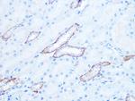 IRAK2 Recombinant Rabbit Monoclonal Antibody (10G3F8)