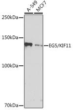 KIF11 Recombinant Rabbit Monoclonal Antibody (6G8V8)