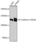 K-cadherin Recombinant Rabbit Monoclonal Antibody (5N2K3)