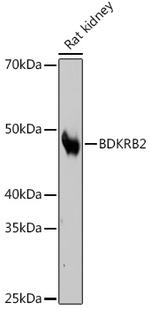 BDKRB2 Recombinant Rabbit Monoclonal Antibody (5O4M5)